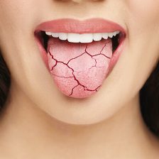 武蔵中原の歯医者、中林デンタルケアークリニックで唾液がねばつく原因と対策を解説