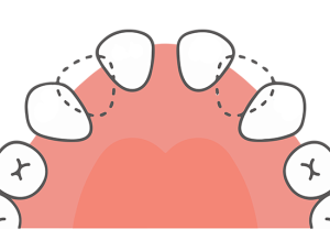 武蔵中原の歯医者、中林デンタルケアークリニックで子どもの乳歯が抜けない・永久歯が生えない場合の原因や対処法を解説