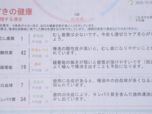 武蔵中原の歯医者、中林デンタルケアークリニックの予防症例、治療前