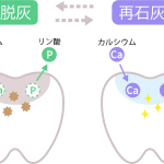 武蔵中原の歯医者、中林デンタルケアークリニックで初期虫歯を削らずに治療する「再石灰化」促進の方法を解説