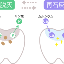 武蔵中原の歯医者、中林デンタルケアークリニックで初期虫歯を削らずに治療する「再石灰化」促進の方法を解説